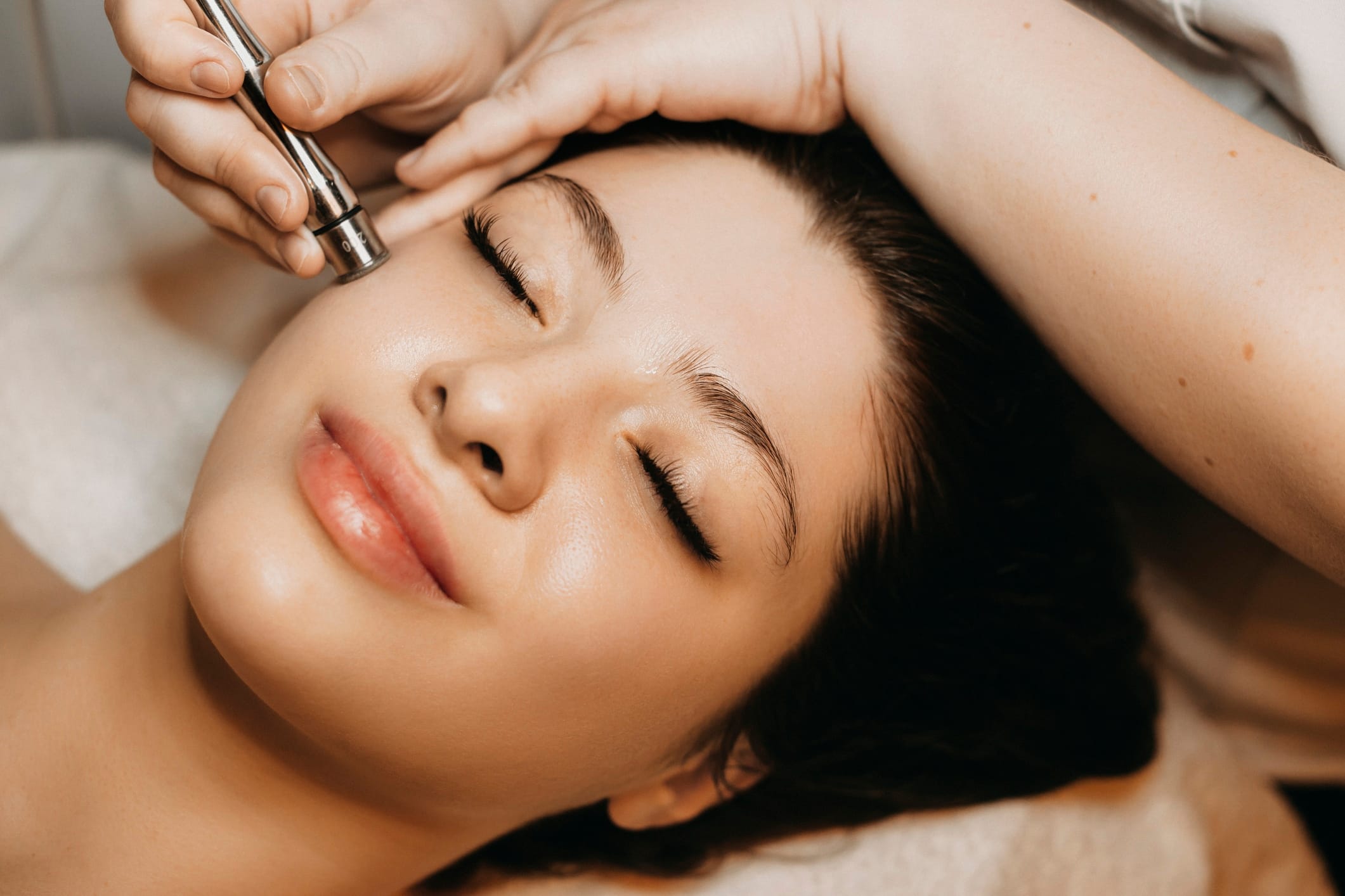 A Women Undergoing Microneedling Procedure