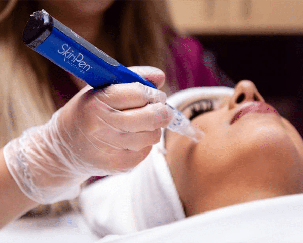 Close up of a gloved hand holding a SkinPen microneedling pen and using it on the face of a woman with her eyes closed and a towel around her hair.