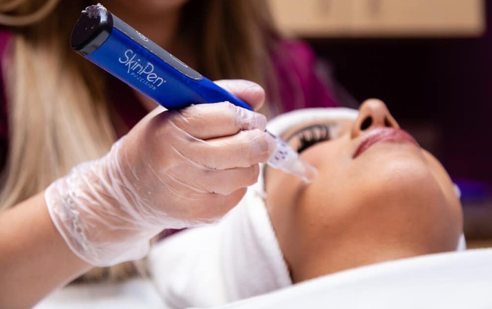 A skincare professional in clear gloves uses a blue microneedling pen tool on a client's face during a skin treatment.